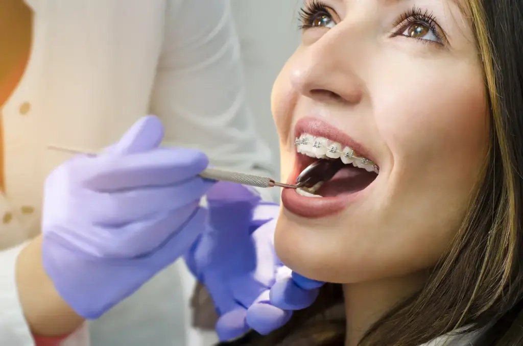 Girl on a Dental Braces Check-up 