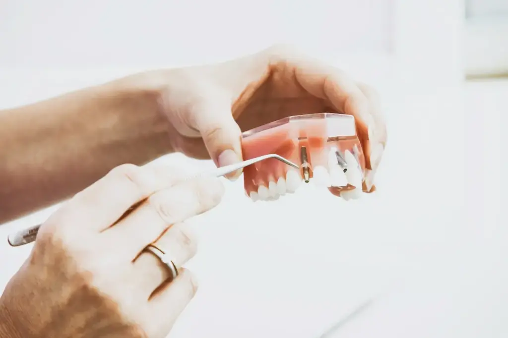 3D Dental Implants 